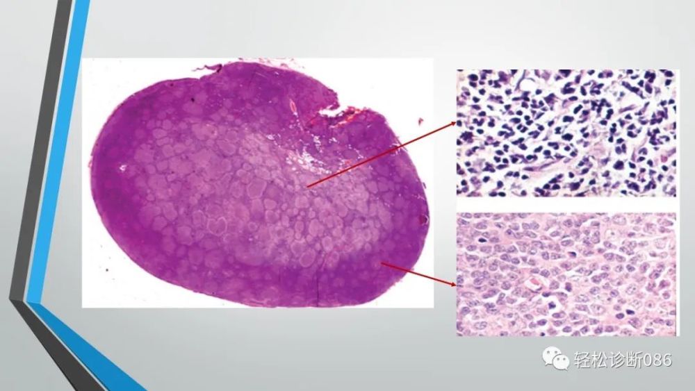 淋巴结he切片的规范化制作