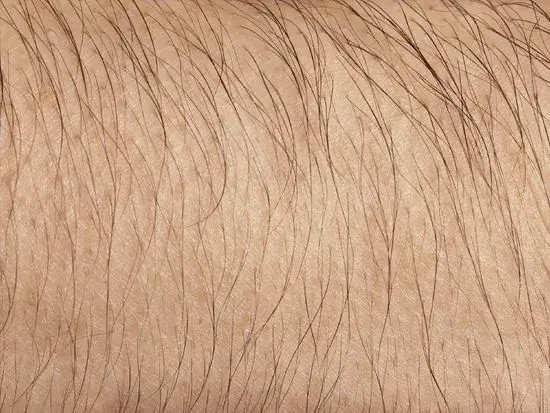 这也就造成了男女身体毛发的不同,当受到大量活性雄激素刺激时候,就会