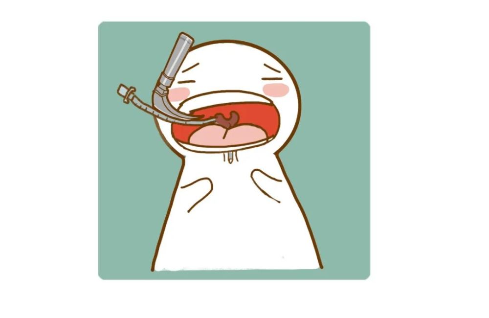 麻醉插管知多少