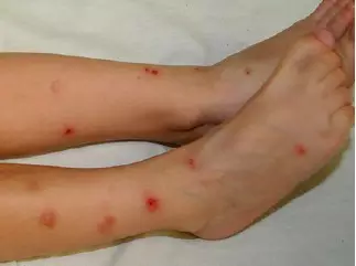 夏季防蚊,看这一篇就够了!