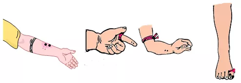 秋季毒蛇出没三明已有多人中招被咬后如何自救