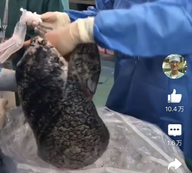 但是,有很多人戒了烟之后会吐出一些黑痰,这些黑痰是什么东西呢?