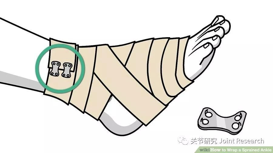 踝关节扭伤别着急学会如何自我处理