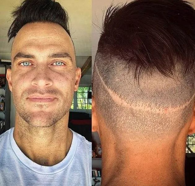 发际线保卫战:44岁好莱坞男星植发5次,明星真实发量让人心酸