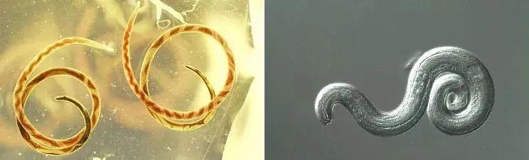 可致死 多地已出现 寄生虫达六千条 夏季来临谨防 致命美味 腾讯新闻