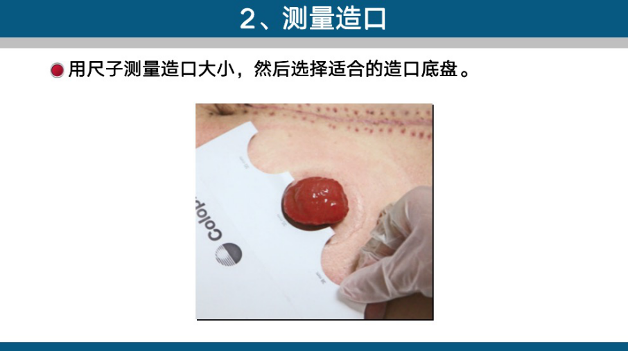 這其中包括:如何佩戴造口袋,造口周圍皮膚如何清洗,如何剪裁和粘貼