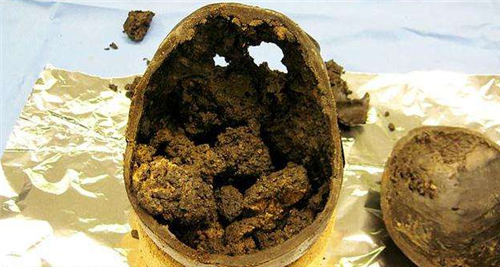 科学家挖出一颗2600年前的大脑,发现还活着,不可思议