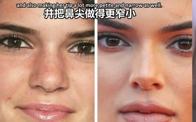 姐妹齐陷整容风波bella肯豆的精致超模脸全是后天养成的