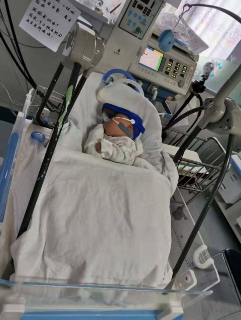 住院7个月成科室"团宠" 极重度肺发育不良早产儿顺利出院
