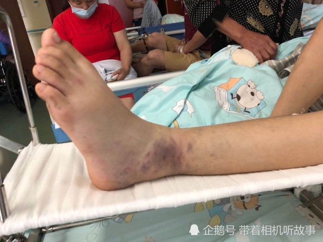 男孩半夜从家神秘消失,醒来发现全身多处骨折,家人为救孩子几近崩溃