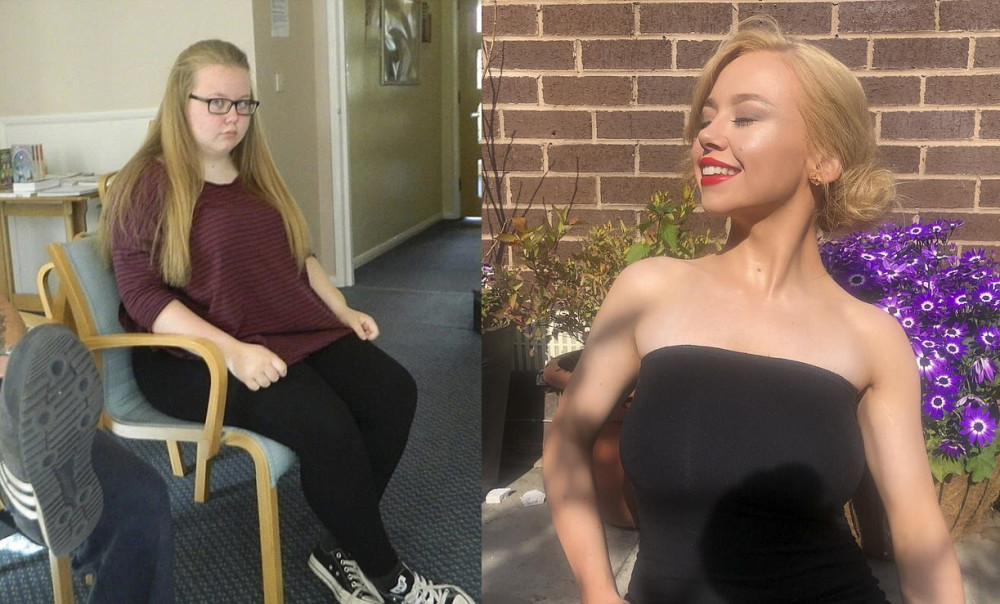 216斤胖女孩梦想当选美冠军,狂减到88斤变苗条美女_腾讯新闻