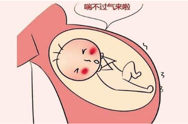 脐血流动容易受阻,缓慢或中断,导致胎儿不良结局,如胎儿宫内发育受限