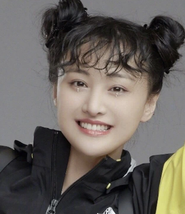 郑爽脸变大五官变小29岁颜值已崩塌网友像米老鼠