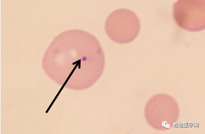 巨红细胞(直径>15um),大红细胞(直径10-15um).