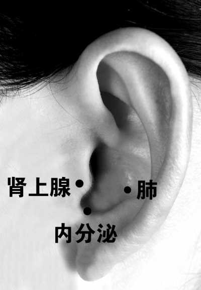 中医教你耳穴压豆去斑法,效果极佳!