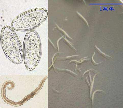蛲虫图片症状图片