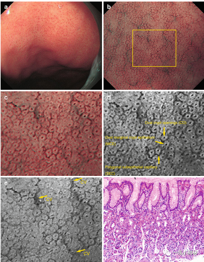 正常胃与十二指肠黏膜结构_腾讯新闻