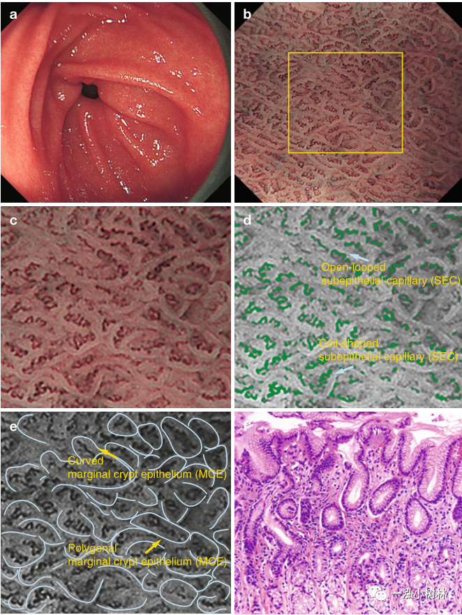 正常胃与十二指肠黏膜结构_腾讯新闻