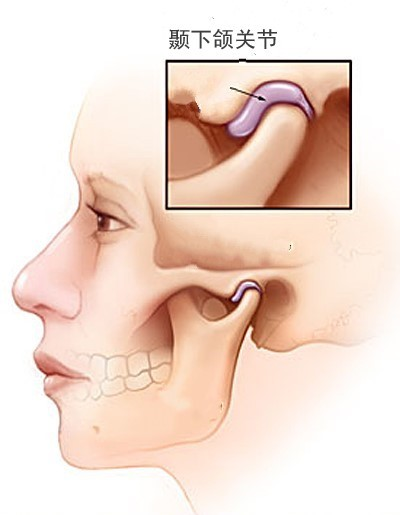 颞颌关节又称颞下颌关节或颅下颌关节,该关节无论解剖形态或生理功能