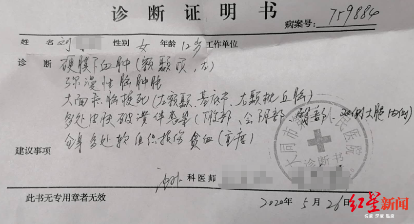 山西12岁女童疑遭继母虐待致脑梗死,检方提前介入