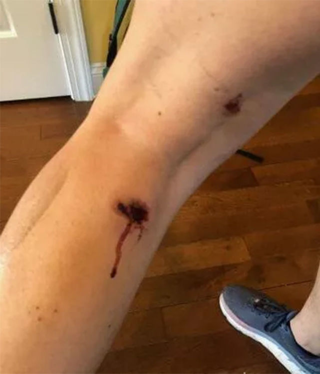 俄媒记者被美国警察用橡皮子弹打伤