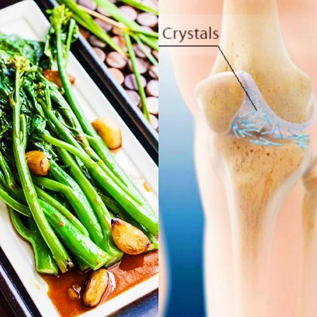 有些蔬菜嘌呤略高,痛风患者不能吃?医生辟谣,给您详细说清楚