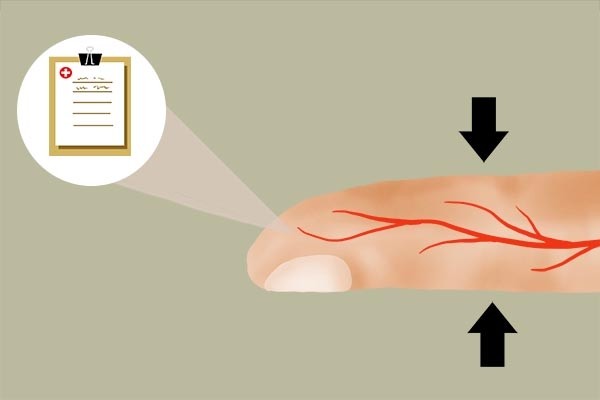 测血糖|测血糖时，第一滴血和第二滴血，哪个结果更准确？不少人都搞错了