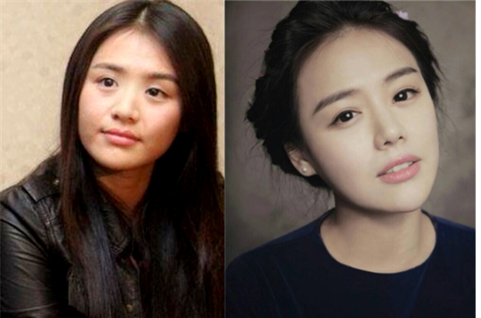 不是在说马思纯整容哈,只是在举例鼻子变得立体之后,李一桐整体钨官