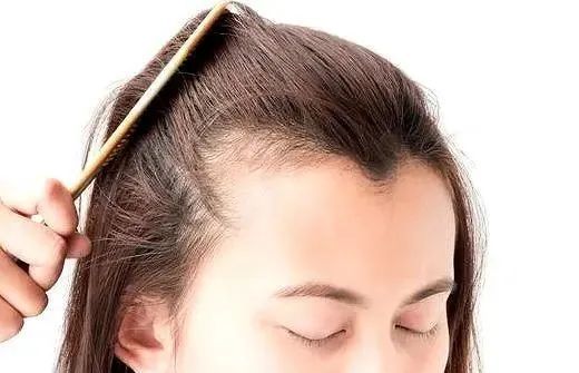 心理测试:你是哪种发际线,测出你这一生的命运是好是坏