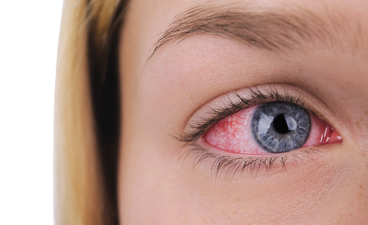 肝火旺的人,少吃3种食物,坚持做好5件事,快速降火又护肝