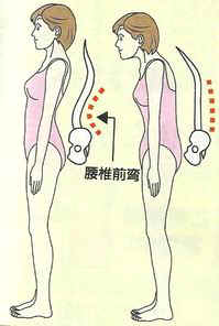 麦肯基疗法 关于维持正确姿势 腾讯网