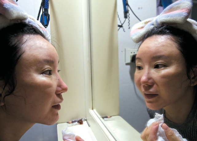 斥400多万巨资整容200次的粉红宝宝现状如何网友没眼看