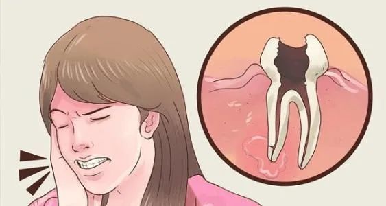 牙疼的时候应该怎么办？该吃药还是该看牙医？