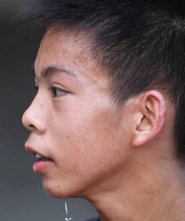 "后浪"独臂男孩:仰望天空 脚踏实地