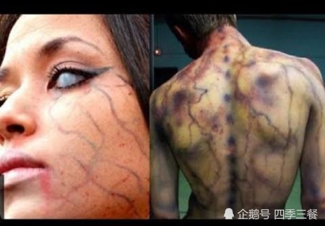 也知道了雷电的原理和蕴含的巨大能量,那到底有没有被雷劈过的人呢?