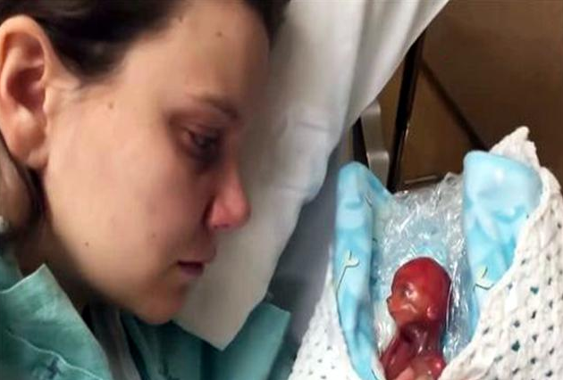 这位孕妇并不算早产,因为早产的概念是妊娠达到28周但不足37周,而泰勒