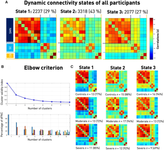 急性缺血性脑卒中|Brain：急性缺血性脑卒中大脑运动网络的瞬态变化