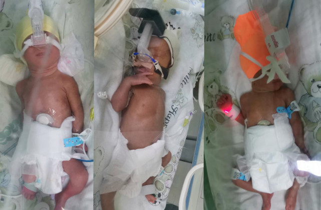 97年女孩诞下三胞胎却以泪洗面取好了名字不知道她们能否用上