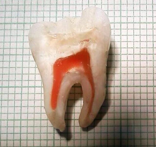 我们牙齿的横截面,看着怎么感觉有点牙疼……人类骨骼的横切面,可能跟