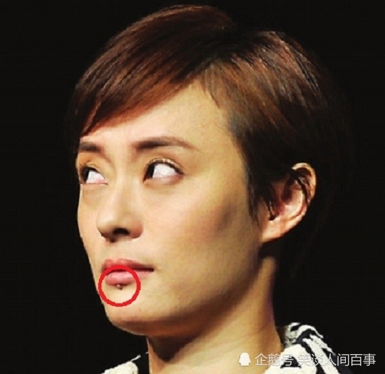 明星三不解孙俪嘴下痘亦菲牙龈露丽颖后背肿各有各坚守
