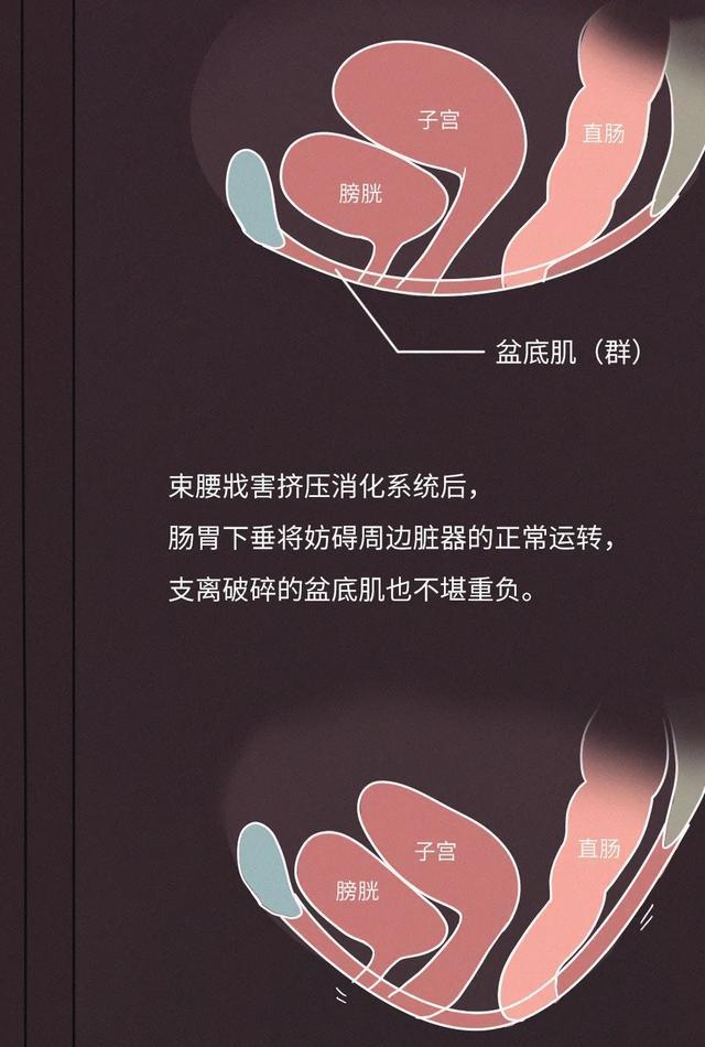下移,这样对生育产生很大的影响,甚至有的人时间久了连膀胱也会脱落