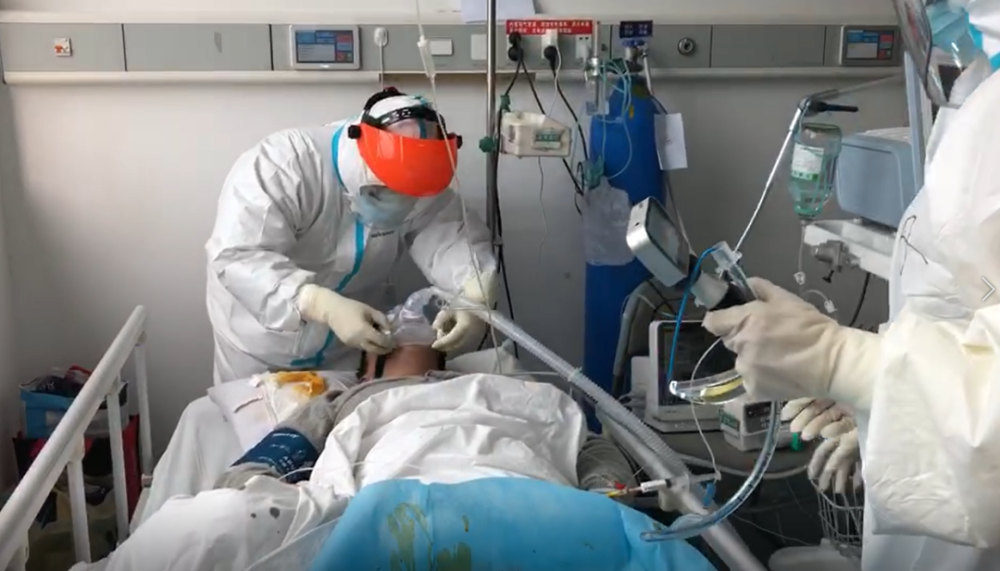 给新冠病人做气管插管在危重症患者机械通气中,特别是气管插管的ards