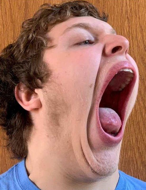 于常人是在9岁的时候,他每次打哈欠都会听到同学们对他的大嘴发出惊叹