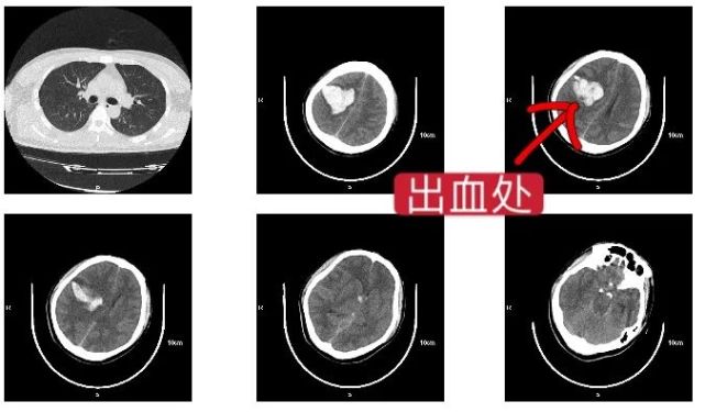 连续加班熬夜东阳27岁设计师差点丢了性命 腾讯网