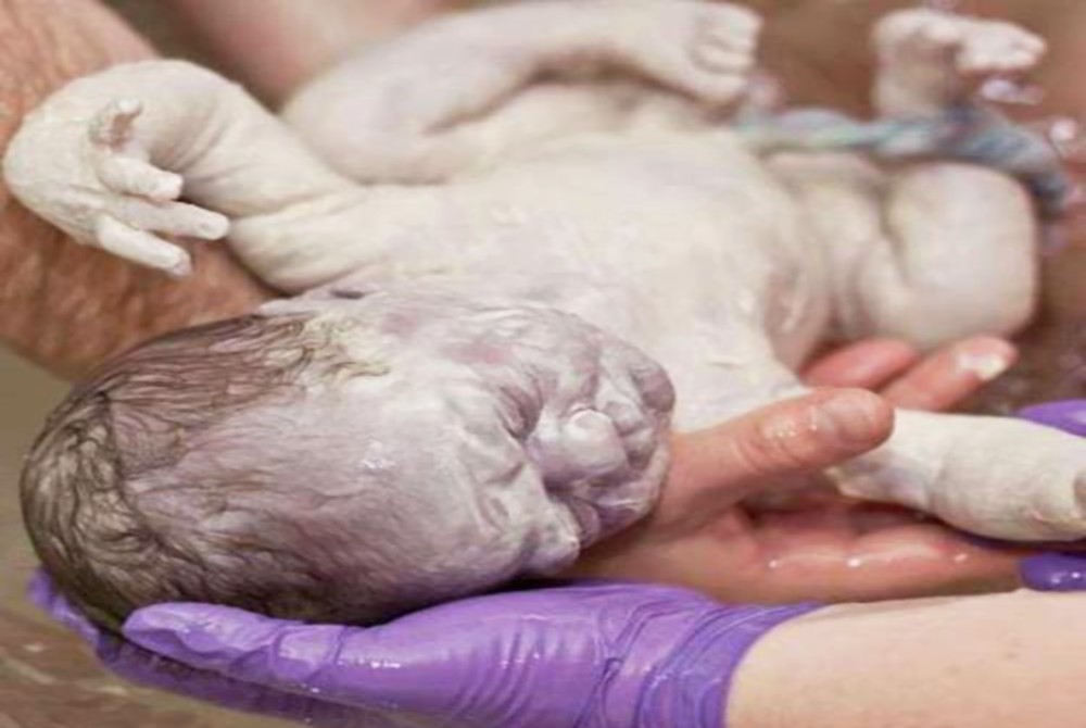 胎脂是在妊娠17~20 周开始形成,妊娠晚期36~38周时胎儿皮肤上胎脂最厚