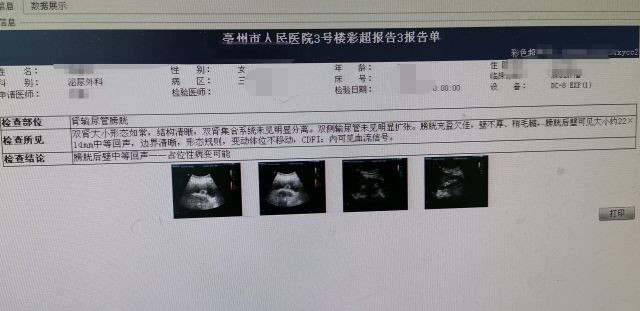 事出反常必有妖,女子檢查彩超發現:膀胱後壁出現了一個22x14mm大小的