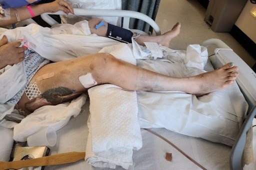 华人珠宝店被洗劫,老板娘腿被打断,网友:向往西方的人该看看