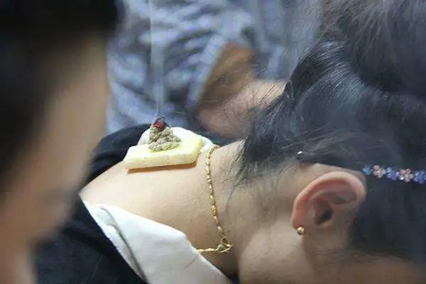 艾灸过程大汗淋漓是否会虚脱艾灸出汗身体排出的是浊水浊气废血