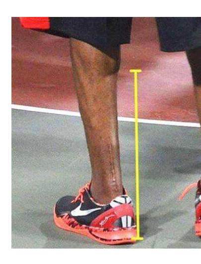 nba球星的痕迹 格林心脏 科比跟腱 羡慕吗?看到11刀的皮尔斯我服