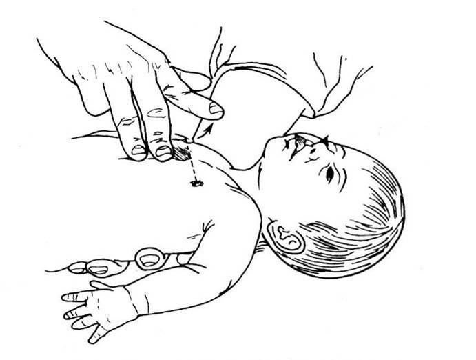 儿童可用单手按压(一手固定孩子头部以便通气,另一只手掌根部置于胸骨